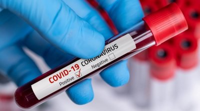 Tunisie-Covid19: 2574 nouveaux cas de contamination et 13 décès