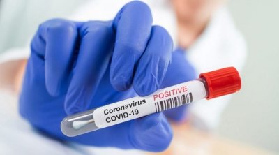 COVID-19 : 5 mille contaminations et 33 décès