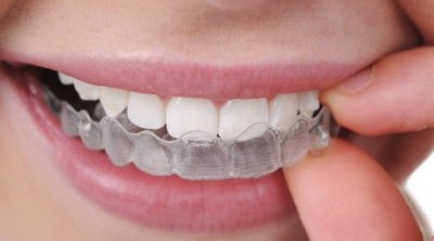 Tunisie : Vers une hausse des tarifs des dentistes