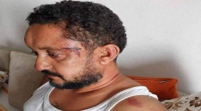 Le SNJT condamne l’agression policière  contre le journaliste Sofiène Ben Njima
