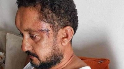 رفض الإفراج عن أمنيين الذين اعتدوا على الصحفي سفيان بن نجيمة
