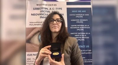 إخترعته باحثة تونسية.. ترياق من سم الأفاعي يعالج أمراض العيون