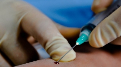 القيروان: إصابة 30 طفلا من نفس القرية بمرض ''البوصفير'' بسبب المياه الملوثة