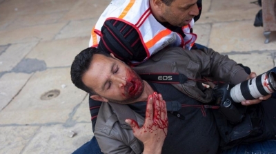 تسجيل 31 اعتداء على الصحفيين خلال شهر فيفري 