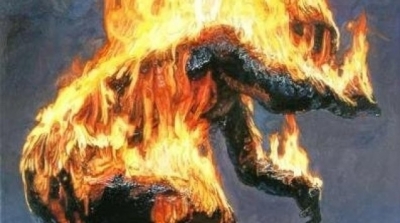 القصرين : طفل يضرم النار في جسده