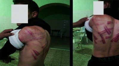 سليانة : سلفيون يعتدون بالعنف الشديد على ابن وكيل في الحرس الوطني