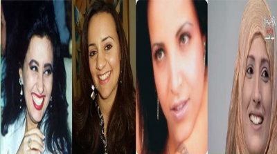  فنانات تونسيات قبل و بعد عمليات التجميل (صور)