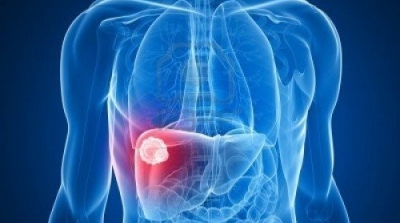 نابل : تسجيل 41 إصابة بالتهاب الكبد الفيروسي أ