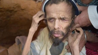 معتمد بني خداش : رجل المغارة لا يشكو من اي مرض 