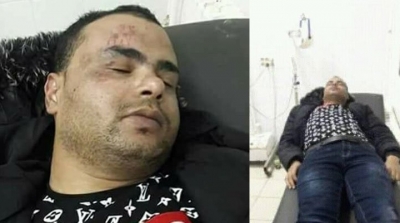 الاعتداء بالعنف الشديد على منذر قفراش (صور)