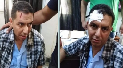 بائع ''هندي'' يعتدي بالعنف على عون شرطة بلدية 