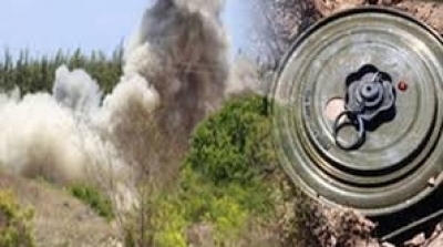 بتر قدم إحدى المصابتين في إنفجار لغم بالقصرين