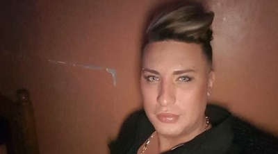 وفاة فنان راي جزائري بسبب عملية تجميل 
