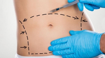 المجلس الوطني لعمادة الاطباء يندد باستخدام الاشهار لاجراء عمليات التجميل  
