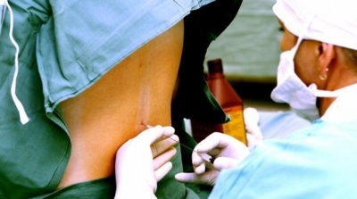 تونس : أول عملية ولادة قيصرية لسيدة مصابة بالكورونا