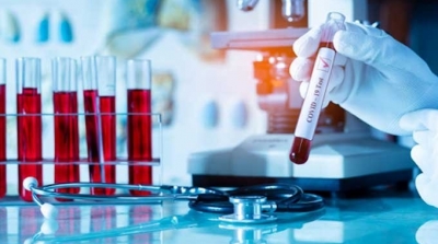 تونس تسجل 129 إصابة جديدة بكورونا : التفاصيل حسب الولايات 