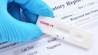 تونس تسجل 64 إصابة جديدة بكورونا 