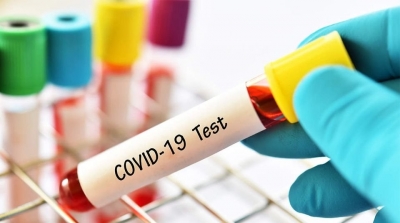 شركات مناولة غير مرخص لها وراء ظاهرة ارتفاع أسعار تحاليل كورونا