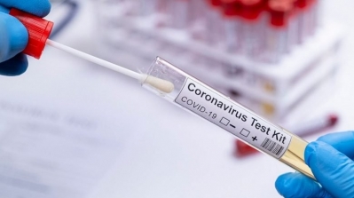 فتح تحقيق ضد مخابر في الترفيع في تسعيرة تحليل كورونا