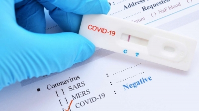 إنقطاع التزود بالمستلزمات المخبرية لتحاليل كورونا على المستوى الوطني