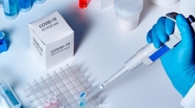 تسجيل 1322 إصابة جديدة بفيروس كورونا