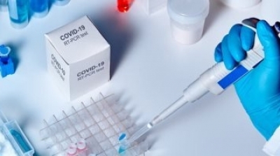 3024 إصابة جديدة بكورونا خلال يومين