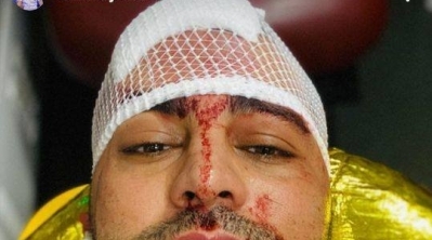 عمار الجمل يتعرض لاصابة خطيرة