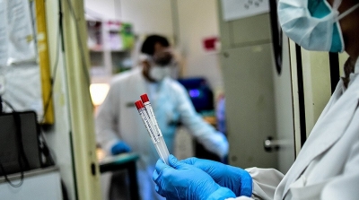 تسجيل 10 آلاف اصابة جديدة بكورونا خلال أسبوع