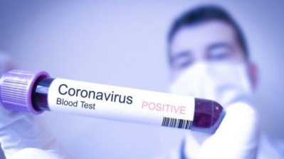 تونس تسجل 48 وفاة و 1094 إصابة جديدة بكورونا 