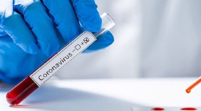 تسجيل 737 اصابة و24 وفاة جديدة بكورونا في تونس 