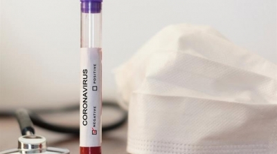 فرنسا ترفض تحاليل pcr المجراة في تونس 