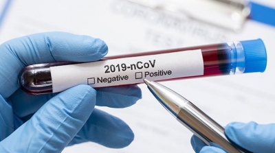 تونس : 42 وفاة و1571 إصابة جديدة بفيروس كورونا