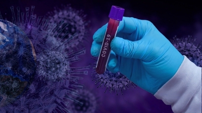 Tunisie-Covid-19 :  Un record de 3638 nouvelles contaminations et 95 décès