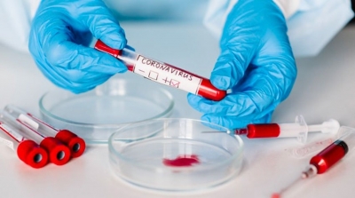Tunisie-Coronavirus : 3524 nouveaux cas et 75 décès