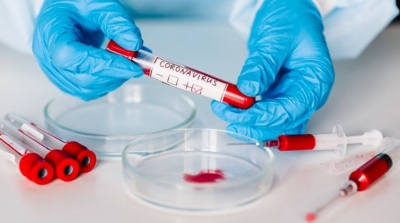 Tunisie-Covid-19 : Un record de 5251 nouvelles contaminations
