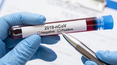 Tunisie-Covid-19: 1883 cas et 22 décès