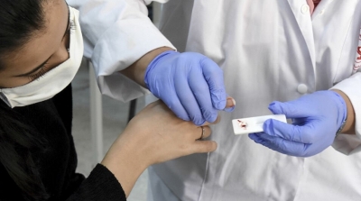 Tunisie-Coronavirus : 23 décès et 1590 nouvelles contaminations